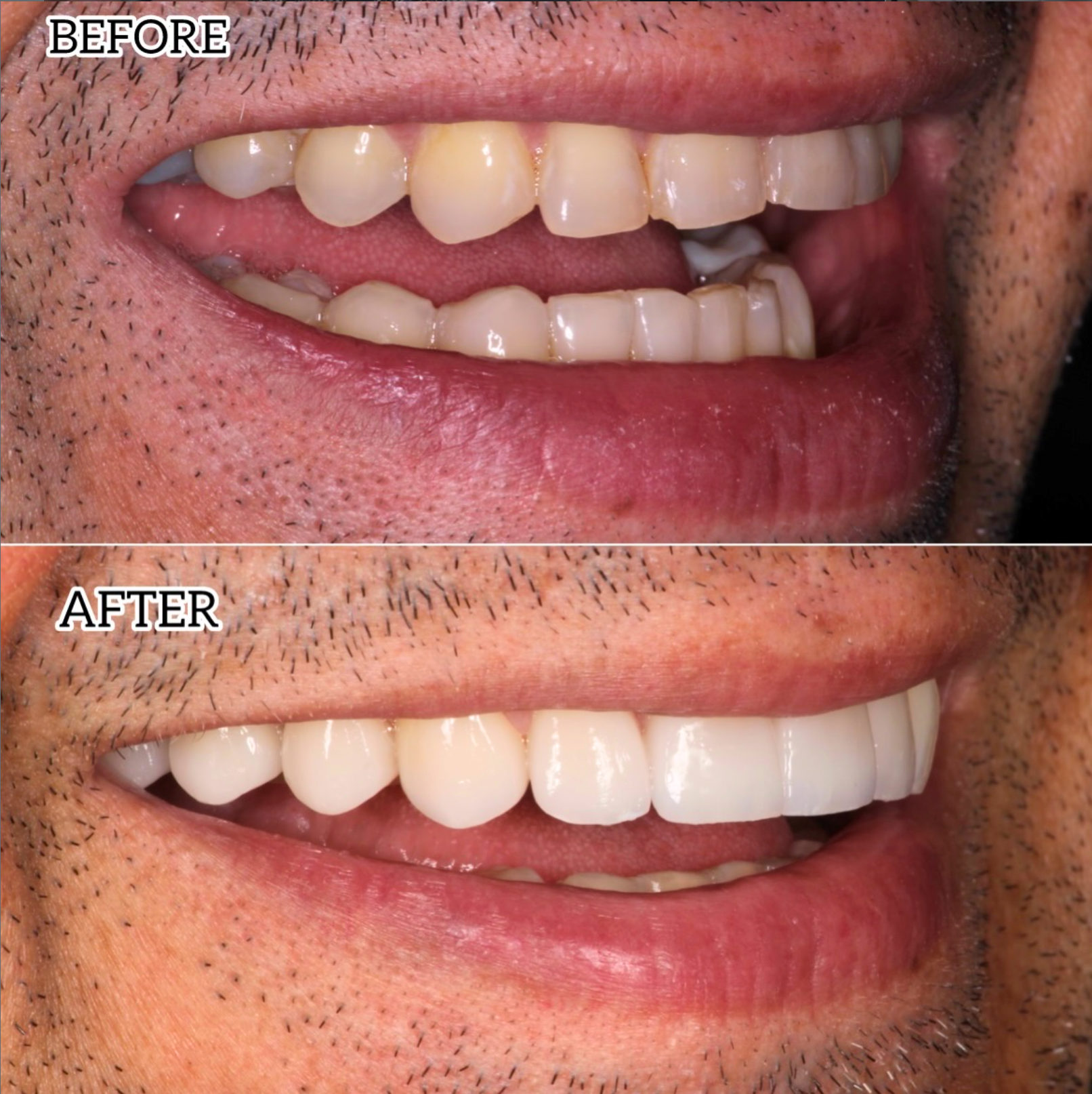 Before and after cosmetic dentistry transformation by Dr. Keith Kennedy